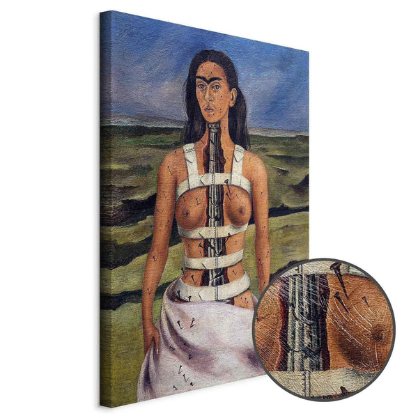 Quadro - Frida Kahlo – The Broken Column