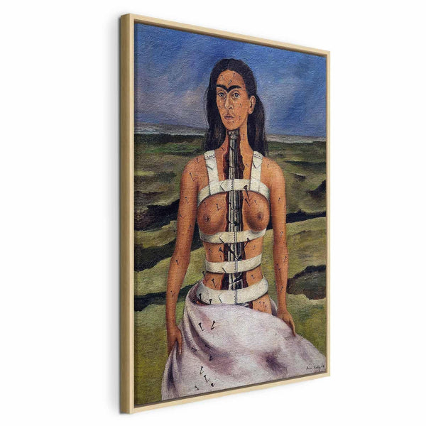 Quadro - Frida Kahlo – The Broken Column