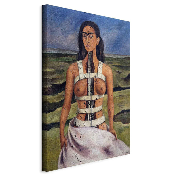 Quadro - Frida Kahlo – The Broken Column